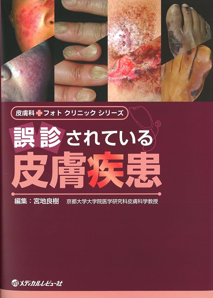 【裁断済み】 誤診されている皮膚疾患 誤診されている皮膚疾患 (皮膚科・フォトクリニックシリーズ